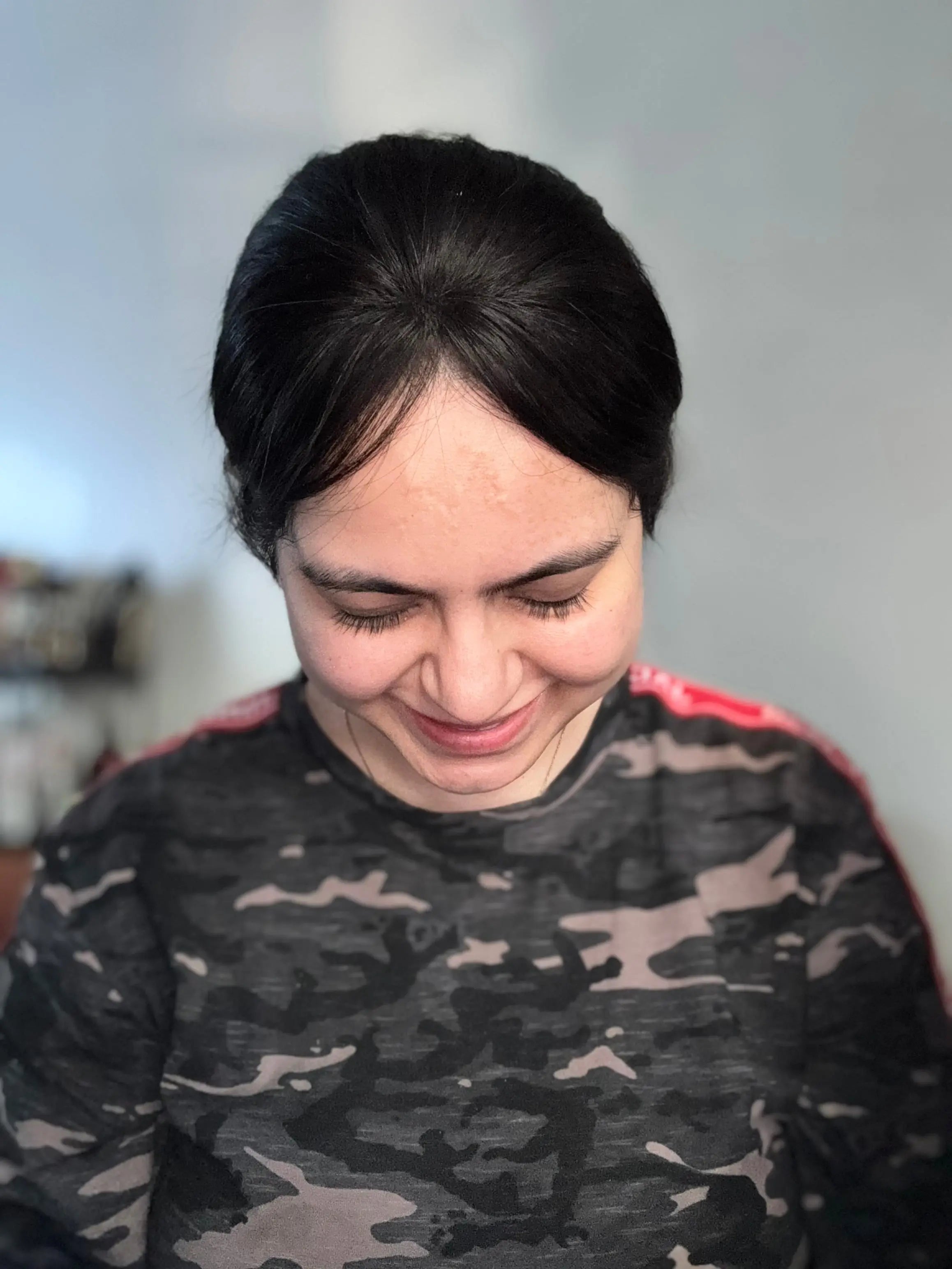 Front Hairline Topper For Receding Hairline | Presh Beauti