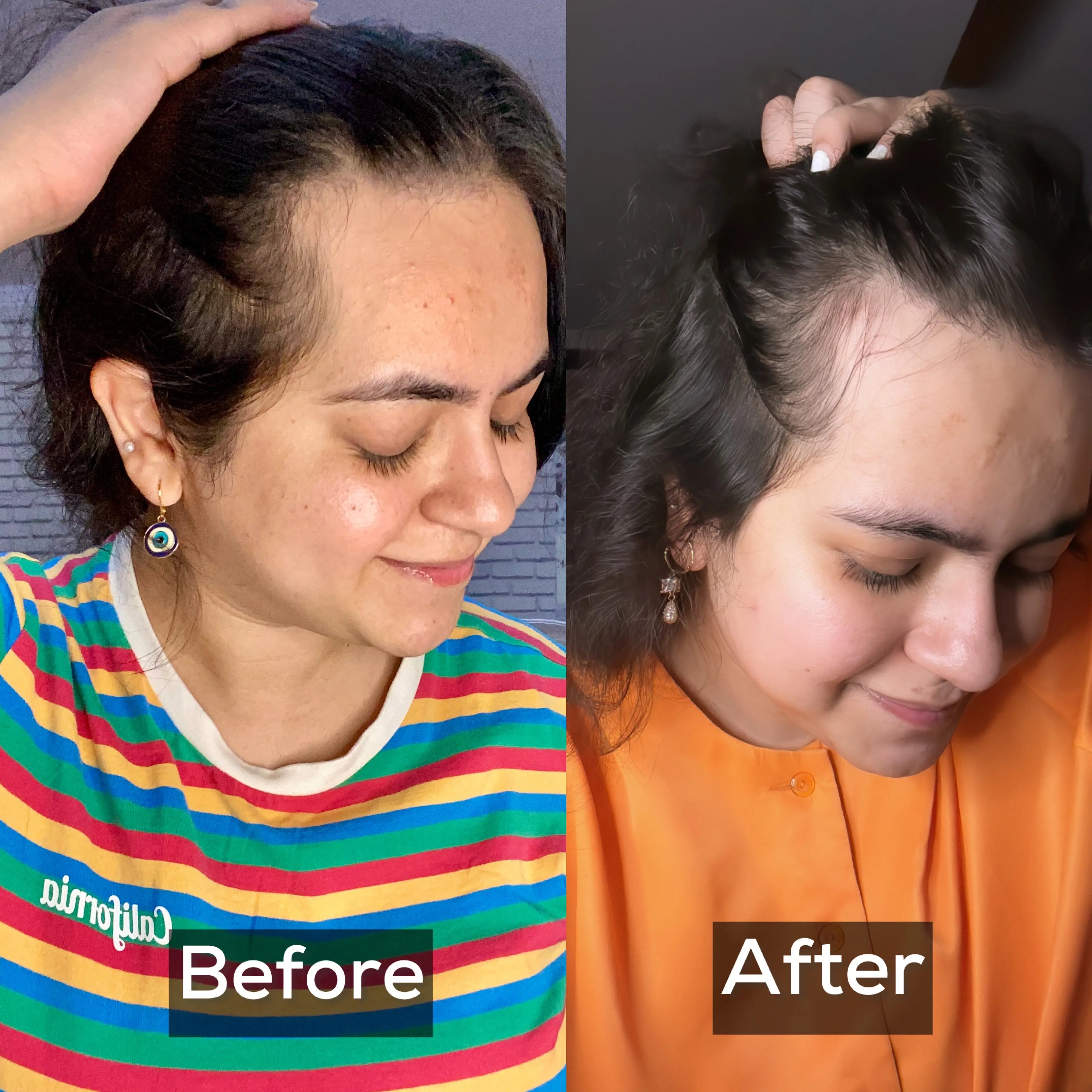 Rosemary Hydrosol For Rapid Hair Growth | Presh Beauti - Presh Beauti